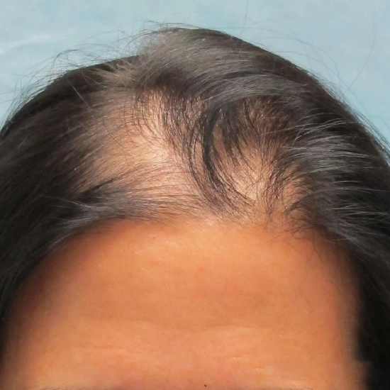 before after 7 (1)