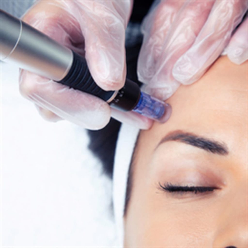 dermapen 51382 b