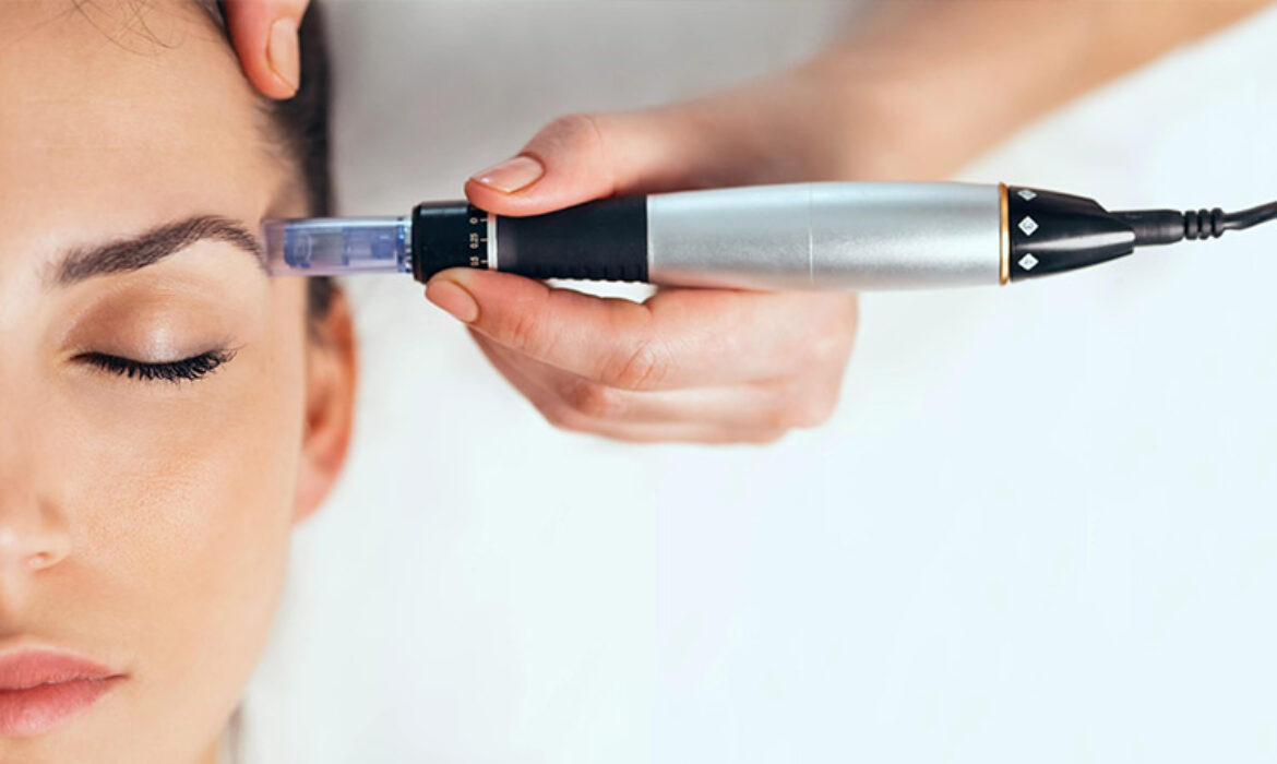 dermapen nedir blog 1170x700