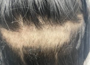 v